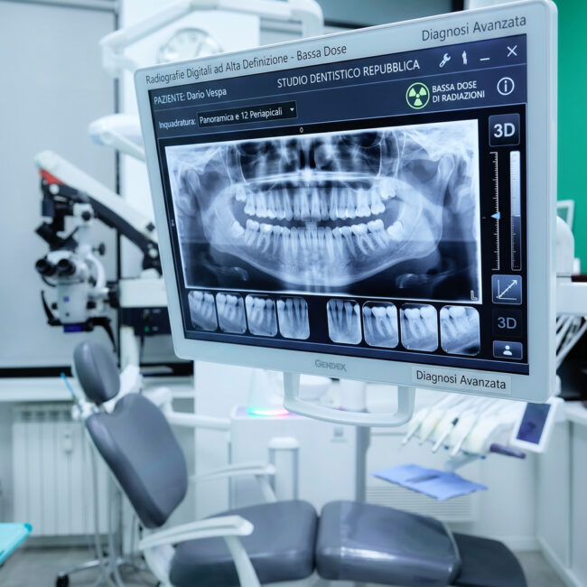 Radiografie digitali