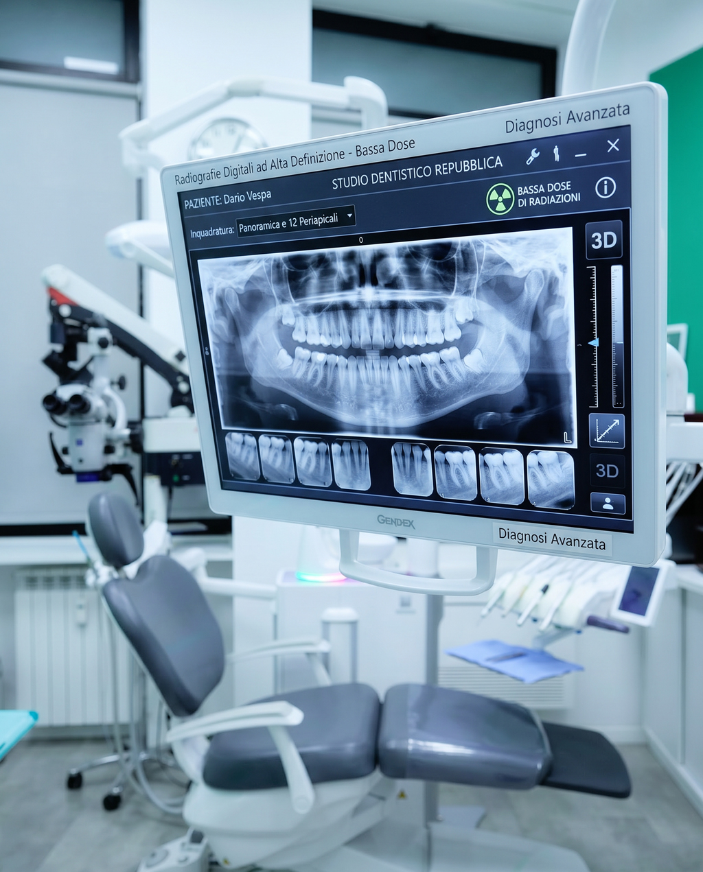 Radiografie digitali